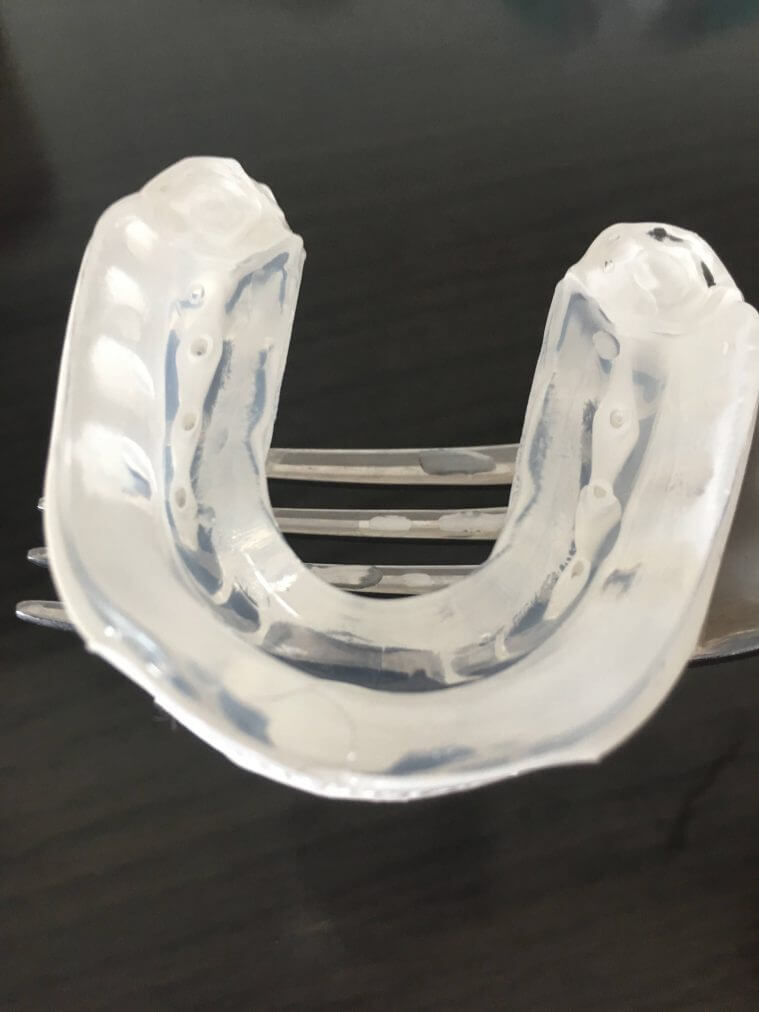 The Best Mouth Guards for Basketball in 2019 Protect Your Teeth!